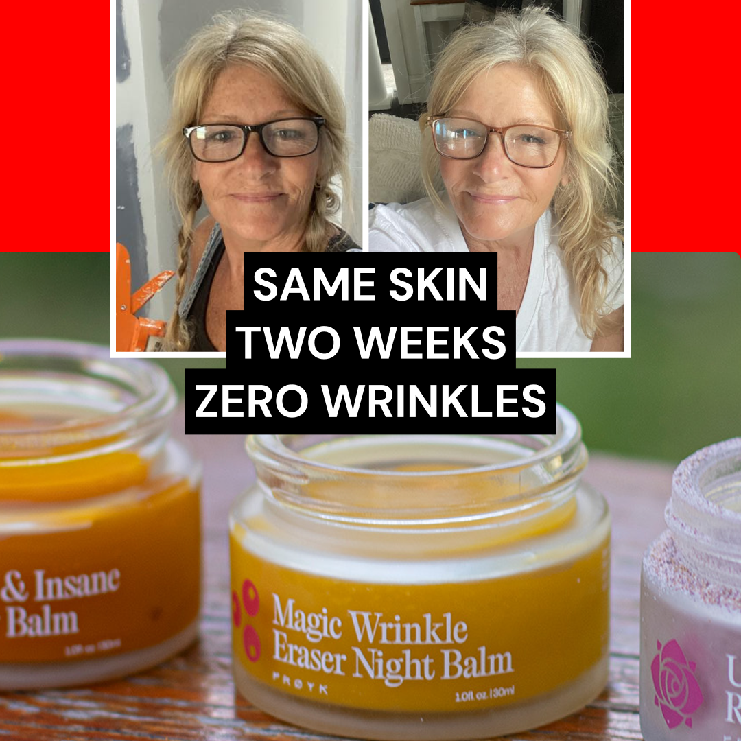 The creative features a split image of a woman with glasses, showing her face before and after using a product. The "before" image shows some fine lines around her eyes and mouth, while the "after" image shows smoother skin. Overlayed on the image in large, bold white text is the headline: "SAME SKIN TWO WEEKS ZERO WRINKLES". Below the split image, two small jars of skincare products are visible, with one jar prominently displaying the label "Magic Wrinkle Eraser Night Balm".