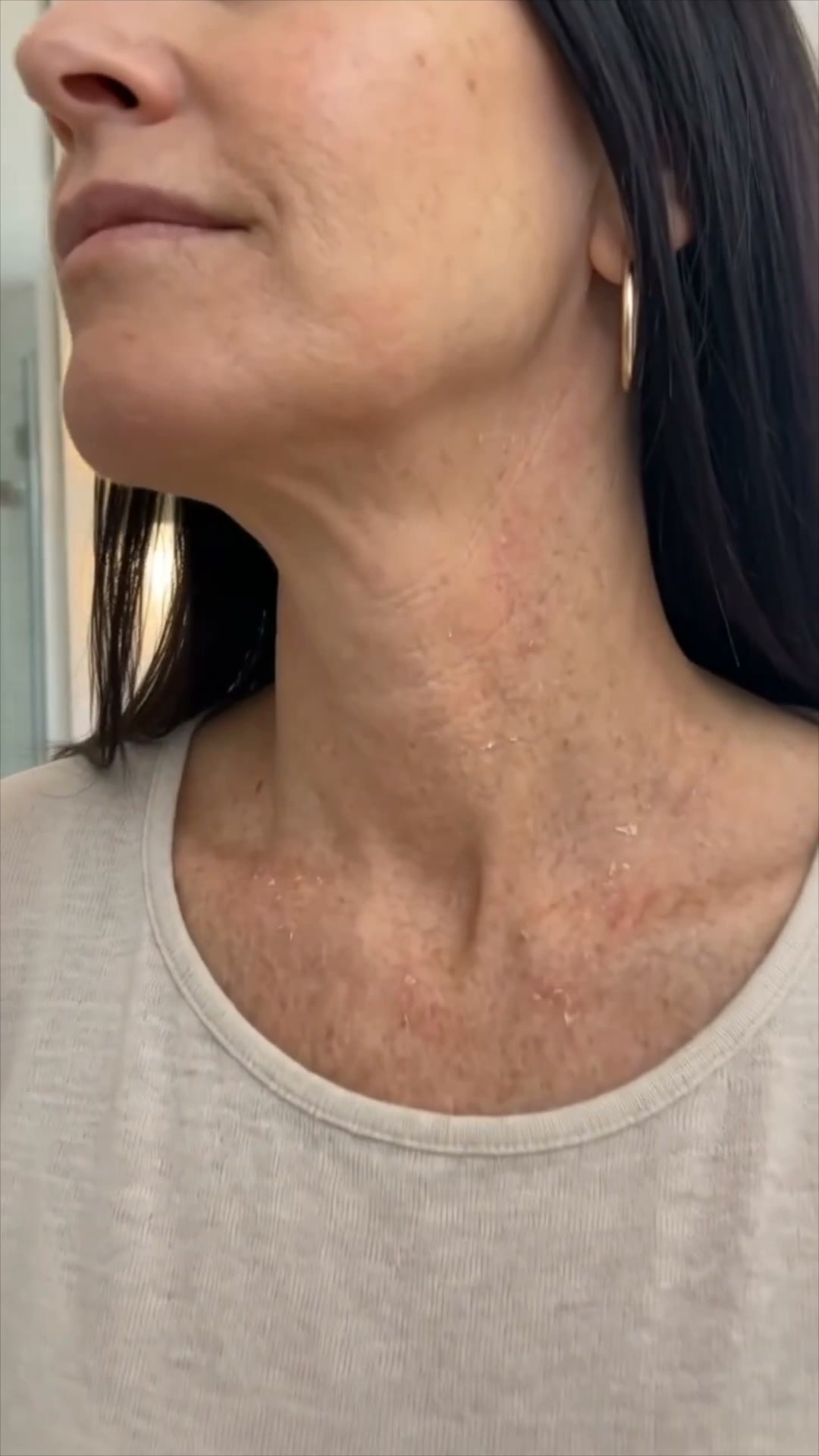 A close-up shot of a woman's neck and décolletage, showing visible skin texture and flakiness. The woman has dark hair and is wearing a light-colored t-shirt. The on-screen text reads, "Prescription tretinoin scared me off retinoids for years." The visual focuses on the skin's condition, implying a problem that the product aims to solve.